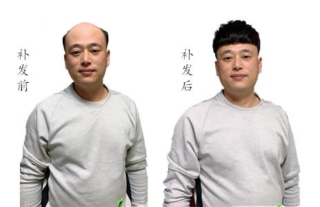 段姐补发男士高端真发假发定制